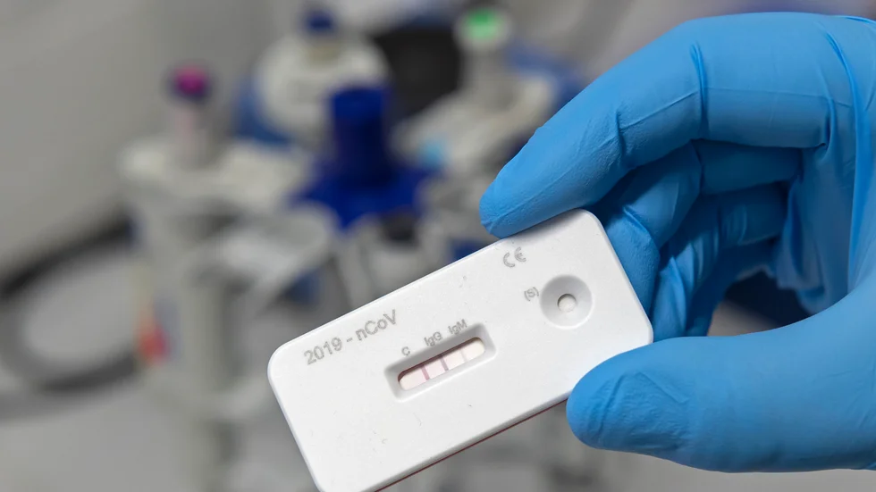 En forskare visare upp ett antikroppstest i ett tyskt laboratorium. Testet visar om en person utvecklat antikroppar mot det nya coronaviruset, men enligt Världshälsoorganisationen behöver det inte betyda att man utvecklar immunitet.