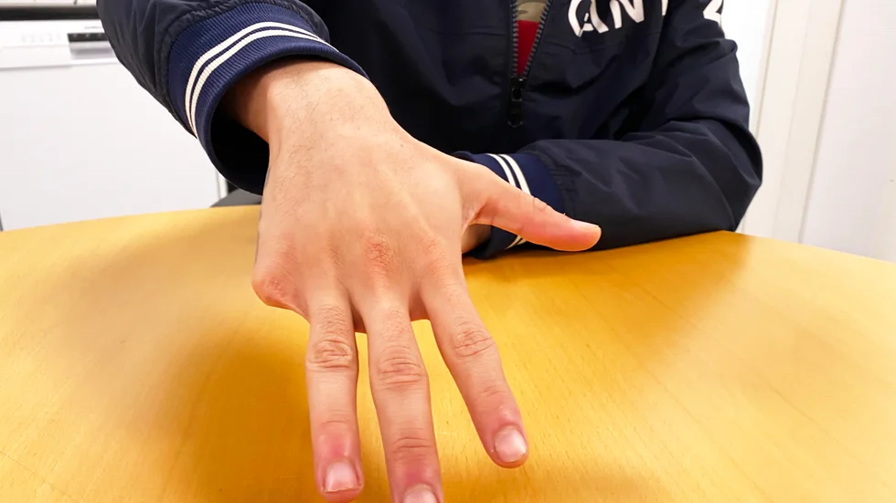 Josef fick sitt lillfinger avknipsat av "bröderna" i det kriminella gänget. "Då vändes allt till hat", säger Josef som i dag har lyckats byta livsstil. Samhällets stöd är avgörande, säger han