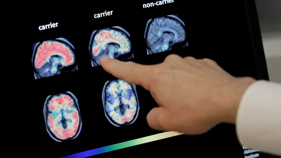 Nu avskaffas boendeformen som hjälpte skribentens Alzheimersjuka mor?