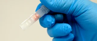 Varför uteblir lungcancerpatienterna?