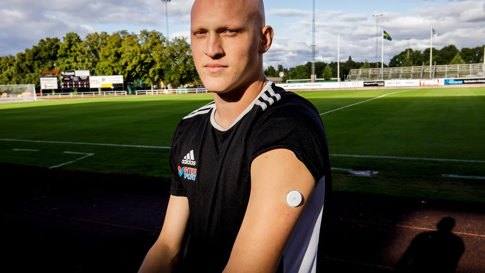 Nu finns det många bra hjälpmedel när man har diabetes. Felix har en sensor på armen som mäter glukosvärdet automatiskt dag och natt. Man slipper då sticka sig själv i finger för att få ut blod. 
