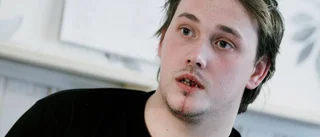 Juris käke klövs av sågklinga - på praktiken