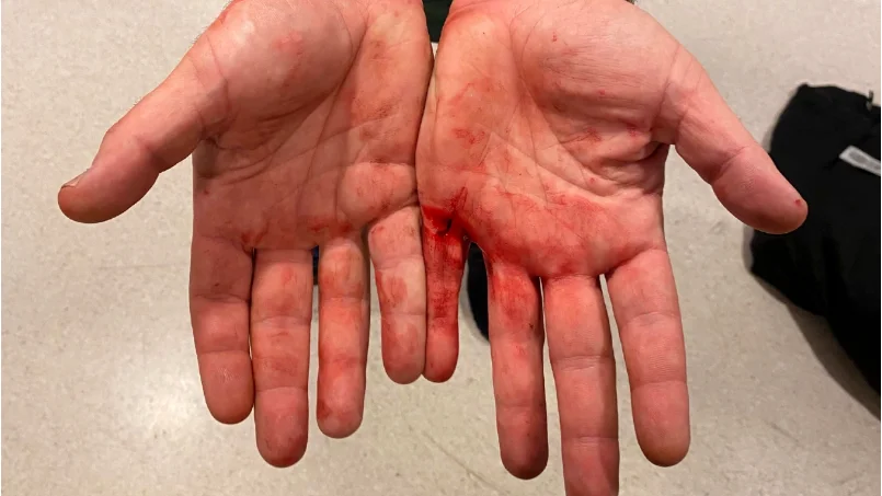 Mannen som misstänks för misshandel och grovt hemfridsbrott ska ha krossat en ruta för att komma in i kvinnans bostad. Vid gripandet fotograferade polisen mannens händer.