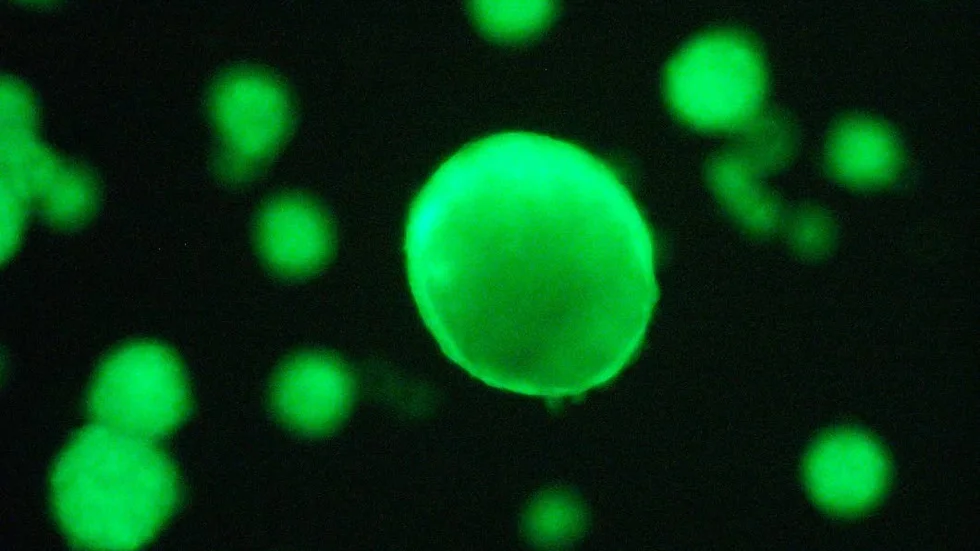 Odlade öar. De gröna ”bollarna” är så kallade Langerhanska cellöar som odlats tillsammans med neurala stamceller. Efter en natt är cellöarna helt täckta med fluorescerande gröna neurala stamceller.