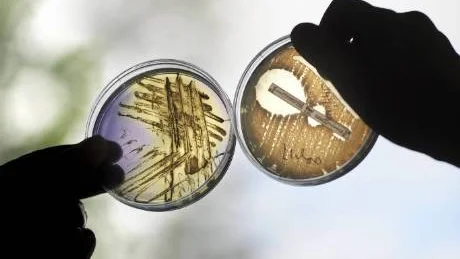 odlade. Proverna som kommer in till mikrobiologiska laboratoriet på Sunderby sjukhus odlas på så kallade agarplattor. De sista åren har det då och då dykt upp bakterier som visat sig vara multiresistenta. Till vänster syns en odling med resistenta stafylokoccus aureus, till höger resistenta ESBL E colibakterier.Foto: Anders Alm