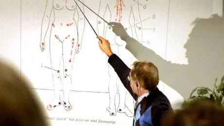 KVINNOSJUKDOM. Fibromyalgi klassas som en kvinnosjukdom. Enligt docent Birger Fagher, Lund, är 90 procent av de som drabbas av sjukdomen kvinnor. Här visar han på vilka ställen på kroppen patienter upplever smärta.