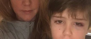 Alfred, 7, sparkades av älg i ansiktet
