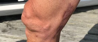 Heintz var hjärtdöd – räddades av sin fru