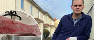 Robin får ingen hjälp med sina kraftiga hudproblem: "Det är bara stora köttsår"
