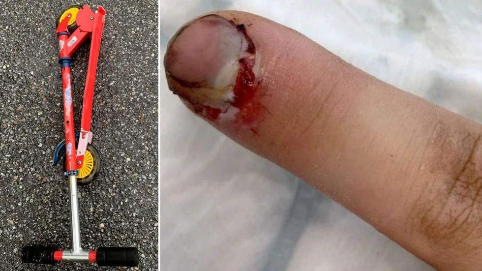 En man i 20-årsåldern åtalas för nio fall av misshandel. Vid en av misshandlarna ska mannen upprepade gånger slagit en kickbike i huvudet på en annan man.