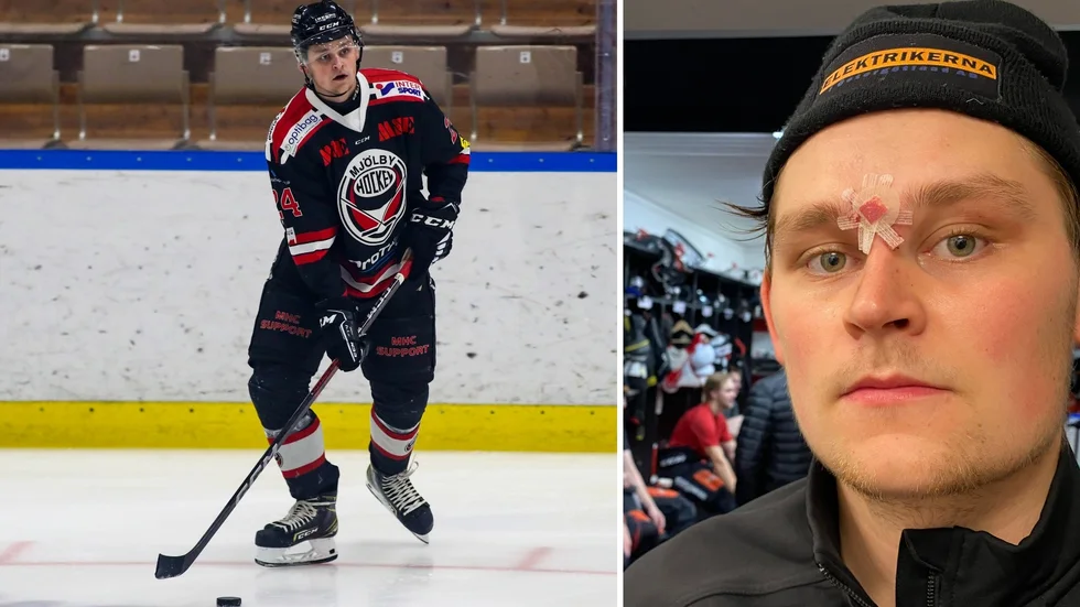 Arkivbild Hugo Andersson, Mjölby HC. "Extremt skönt när Bremer satte avgörandet", sa han efter matchen. Pucken i ansiktet resulterade i sju stygn.