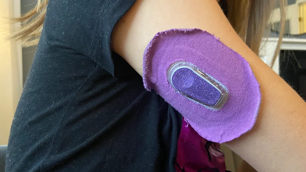 "Vi försöker göra hennes måsten lite roligare" säger mamma Sarah och syftar här på den lila tejp Alma fått på sin arm. 