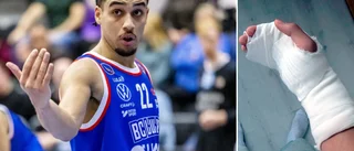 Dråpslaget – lagkaptenen i gips efter smällen