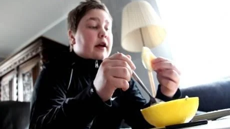 Narkolepsi. Anton Svensson har svårt att kontrollera musklerna och när händerna darrar är det svårt att äta.