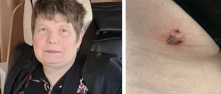 Marie klev av pendeltåget – då attackerade hunden: "Fick så ont"