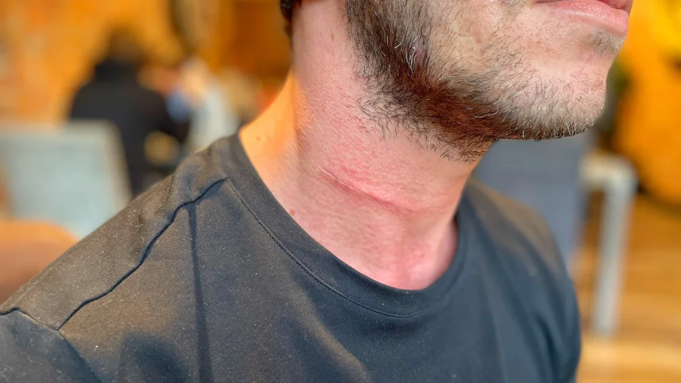 Jonas vill inte visa sitt ansikte på bild när han pratar om hur han blivit behandlad inom vården. Han är rädd att bli igenkänd på sjukhus och vårdcentral om han skulle behöva hjälp i framtiden, och då inte få rätt hjälp.