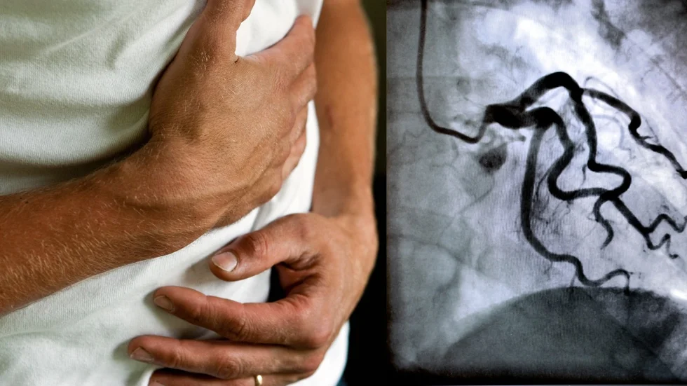 Patienten fick inte hjälp med sin hjärtinfarkt.