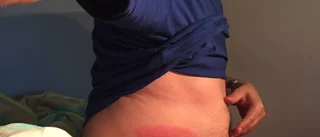 Borreliasjuk får inte klaga