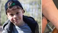 Huggorm föll från träd i Vallaskogen – bet 7-årige Adrian i armen