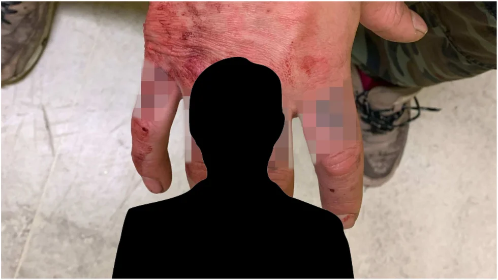 När mannen greps i Luleå hade han blodiga händer som han själv säger kommer från ett slagsmål.