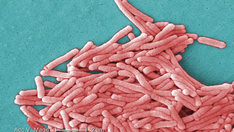 Legionella är som en svår typ av lunginflammation. Arkivbild.