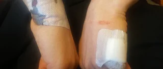 Ali bets blodig – får pengar av polisen