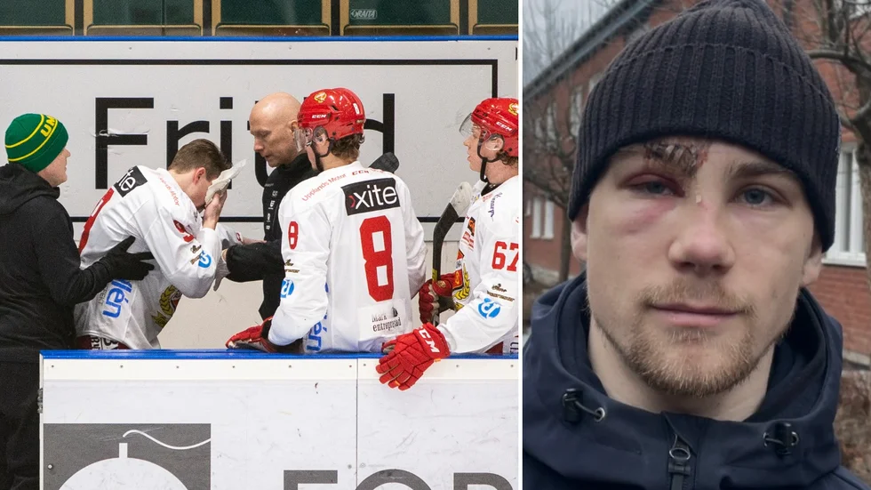Skottet tog illa på Hampus Harlestam trots att han skyddades av hjälm. Blodet rann ordentligt och det krävdes många stygn för att lappa ihop Harlestams ansikte. Ett par dagar efter händelsen mår Almtunaspelaren rätt okej.