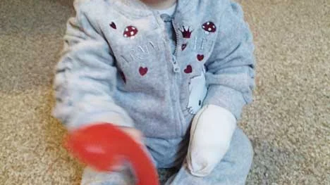 Den traumatiska hÃ¤ndelsen verkar dess bÃ¤ttre inte ha lÃ¤mnat nÃ¥gra spÃ¥r hos Iira-Riina Juvonen, tio mÃ¥nader, fÃ¶rutom att handen Ã¤r lite blÃ¥-gul, som ett blÃ¥mÃ¤rke, och fÃ¶rsedd med bandage. Hon Ã¤r glad och leker som vanligt.