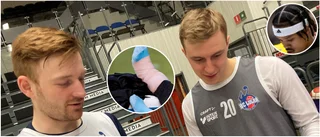 Isade fel fot efter stukning • Han härmar stjärnornas frisyrer 