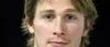 Benkelius tvingas till vila