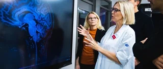 Forskarnas slutsats: Covid förändrade hjärnans struktur