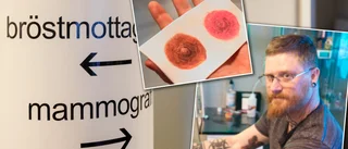 Tatueringar sätter vårtgårdar på plats efter operationer