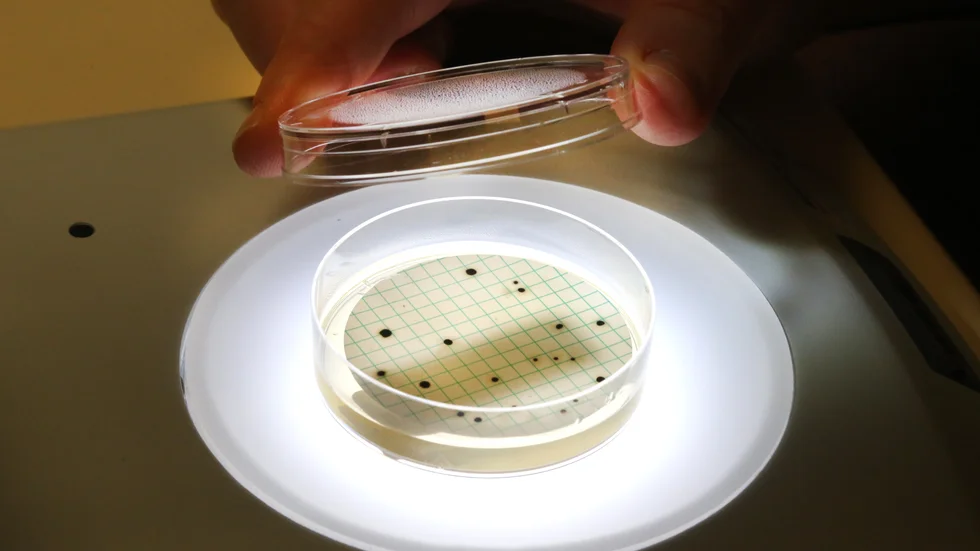 Bakterien Clostridium syns med blotta ögat när den efter bara en dag i näringslösning vuxit til sig.
