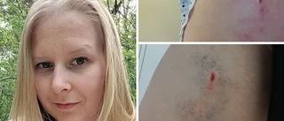 Marja, 29, attackerades av hund i Torshälla – blev biten i låret: "Ägaren klarade inte av att hålla hunden"