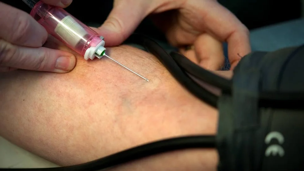 PSA-prov. Provtagning för indikation på prostatacancer kallas PSA-test, och tas med ett vanligt blodprov.