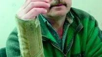 Conny Olofsson hoppas att en steloperation ska hjälpa honom att bli av med värken efter en 35 år gammal skada. Men han är orolig över att tiden går.
FOTO: TITTI OLOVSSON (0122-131 75)
titti.olovsson@folkbladet.se
