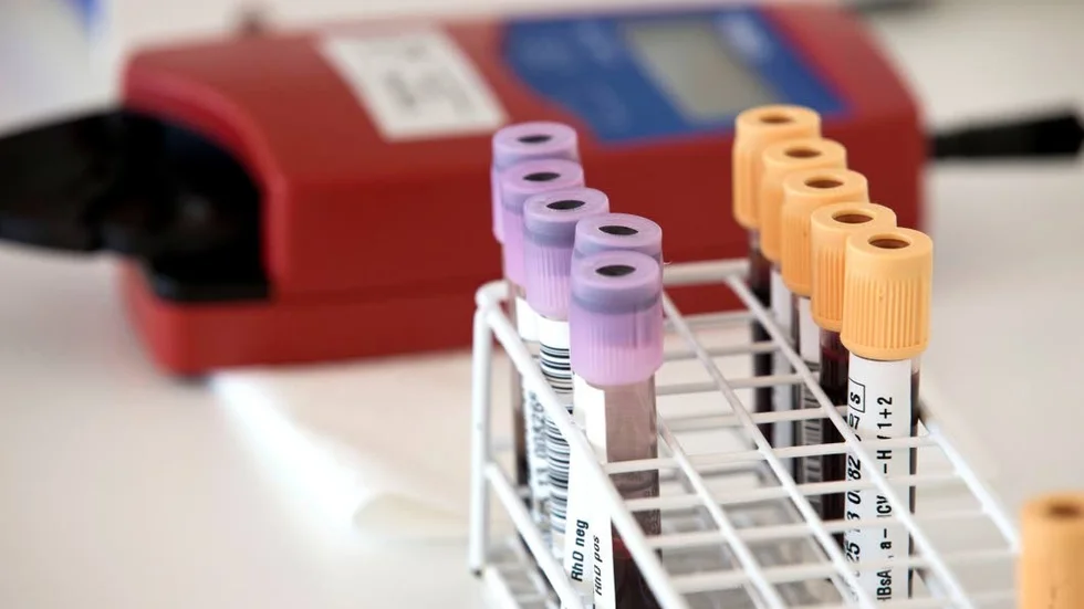 ANALYTIKER. I Piteå fick personalen för några år sedan bättre arbetsvillkor, men nu har arbetsgivaren återinfört beredskap som gör att de biomedicinska analytikerna mår sämre och servicen på sjukhuset när det gäller diagnossättning har försämrats under nätterna.