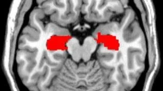 En magnetkamerabild av en hjärna med det för minnet mycket viktiga området hippocampus markerat i rött.