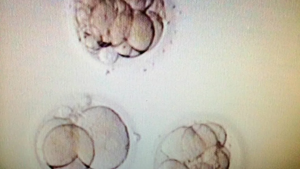 Utseende. Snyggast behöver inte vara bäst. Det är med embryot överst som chansen till barn är högst.