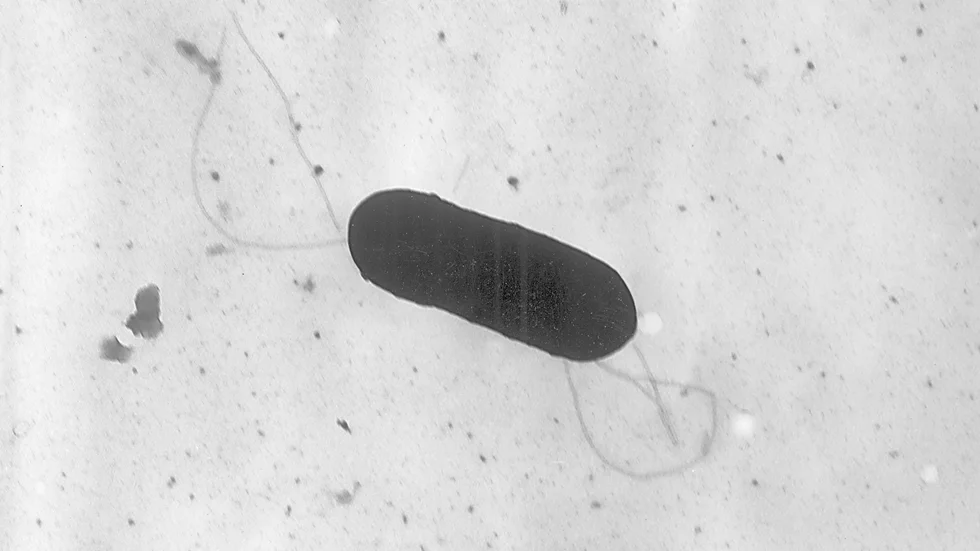 Listeria, en bakterie du inte vill ha på ostmackan.  