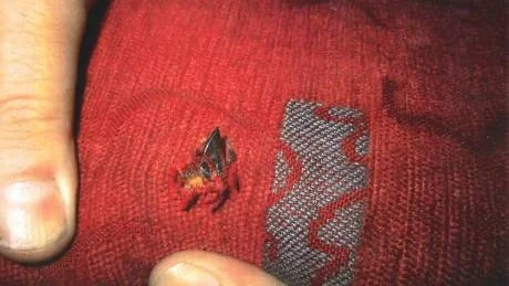 INMONTERAD. Skalpellen satt djupt in i sätet, en tång fick användas för att få ut den. Foto: