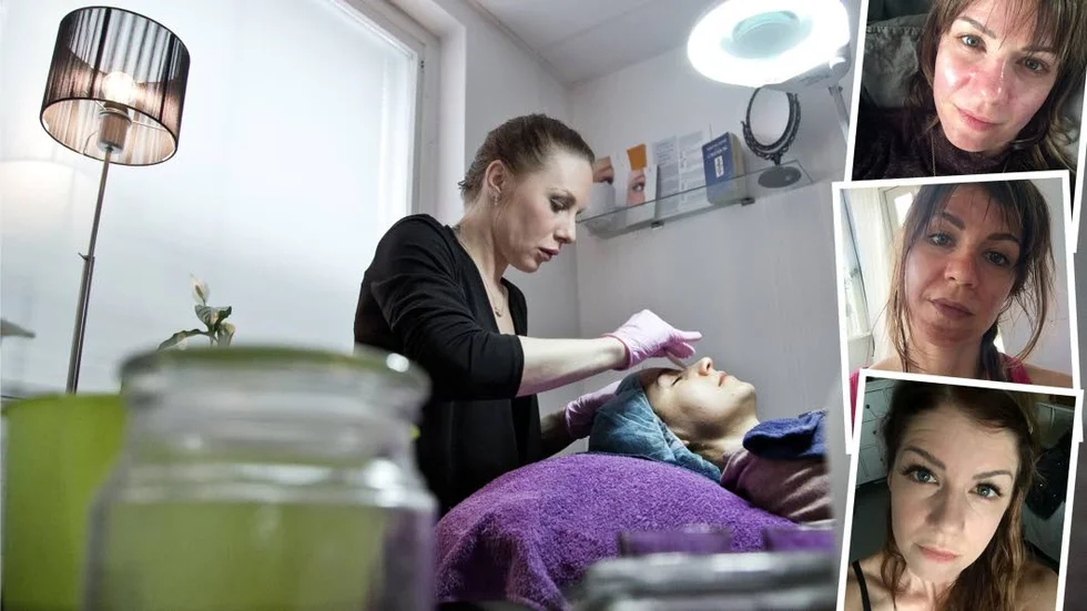Anna Dysholm i full färd med kemisk peeling. Koncentrationen är på topp.