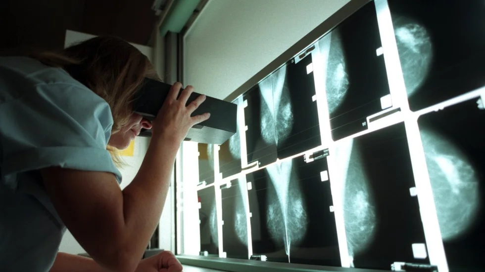 Avgiften för mammografi är en av de som höjs nästa år. Foto: TT