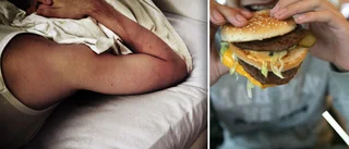 Därför gör sömnbrist dig hungrig – och tjockare • Ändrade halter efter bara en dålig natt