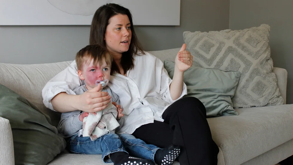 För tre år sedan föddes Lennox med Sturge-Webers syndrom som drabbar 3-5 barn av 100 000.