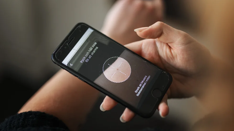 Bildtolkning är ett stort fält där algoritmer kan rädda liv. Här är en app som scannar hudförändringar för att upptäcka hudcancer. 