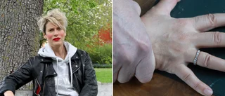 Stor ökning av anmälda våldtäkter de senaste tio åren • ”De tänker att våld ska ingå i sex”