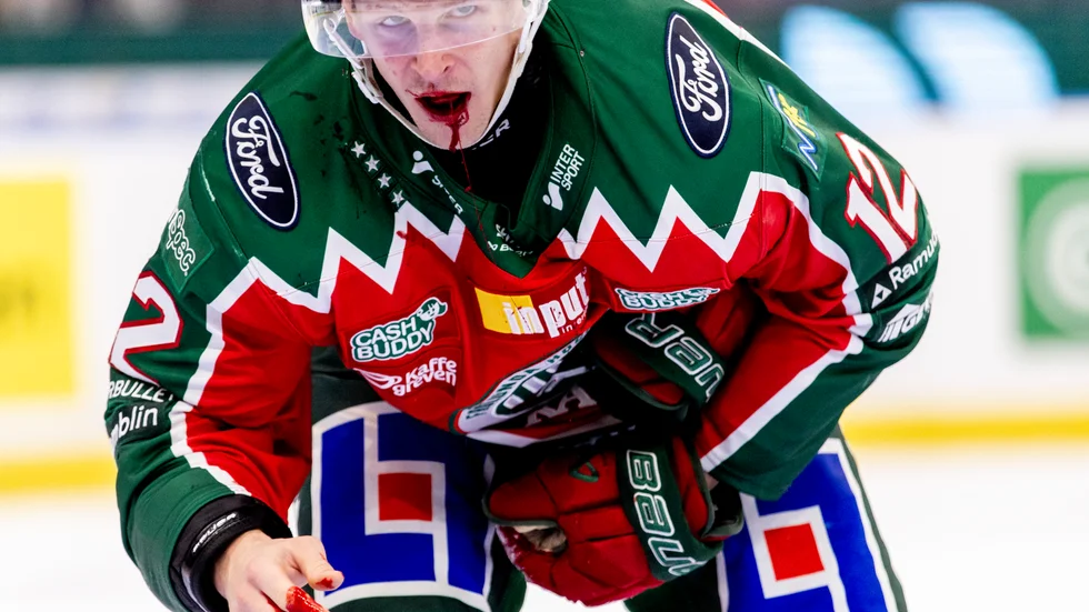 Frölundas Max Friberg förlorade några tänder under torsdagens ishockeymatch.