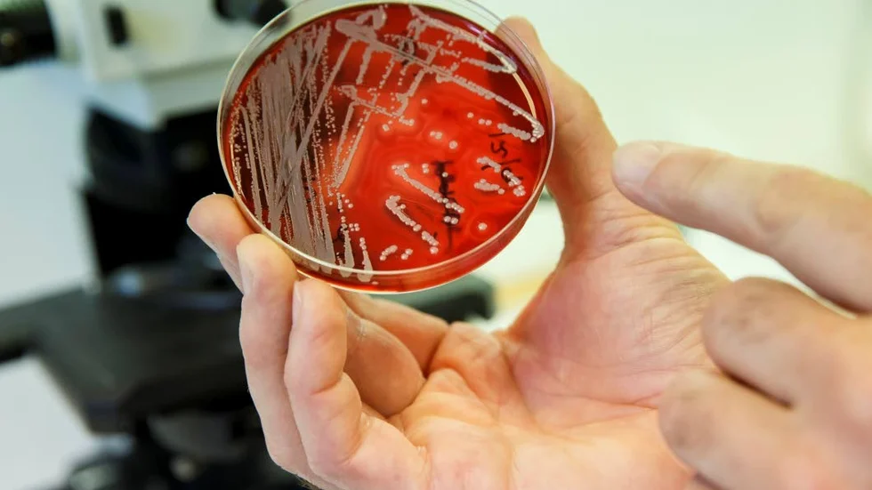 Bakterien på bilden har inget med pseudomonas aeruginosa att göra. Johan Nöjd, smittskyddsläkare vid Region Uppsala, berättar att bakterien är ofarlig om än obehaglig.