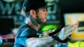 Speedwaystjärnan opererad i timmar – hålls nedsövd
